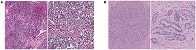 Unsupervised Domain Adaptation for Classification of Histopathology Whole-Slide Images